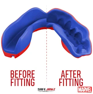 Paradenti SAFEJAWZ  Marvel Spider Man Senior